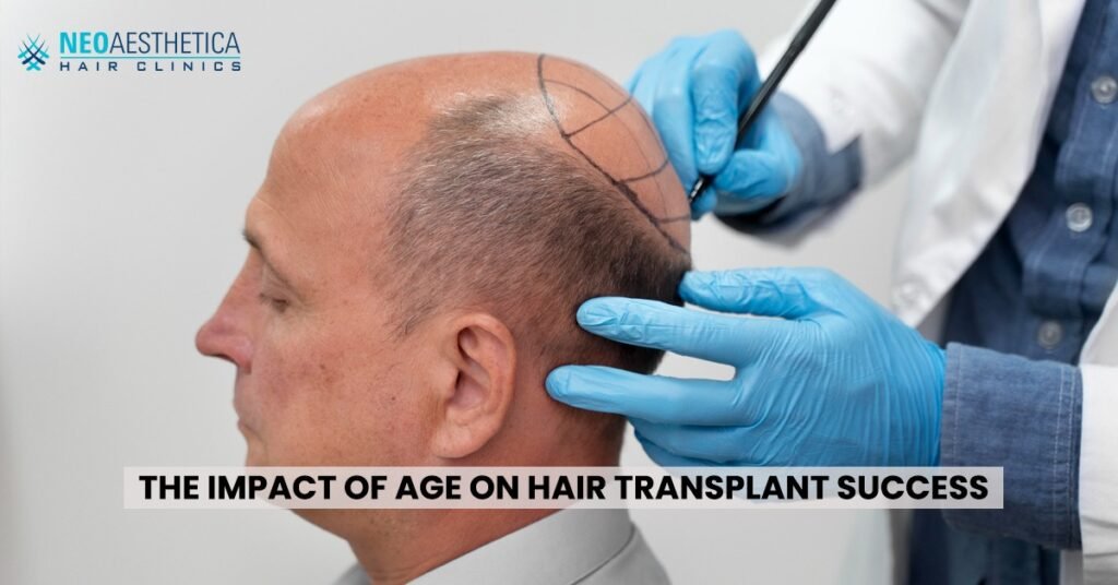 The Impact of Age on Hair Transplant Success