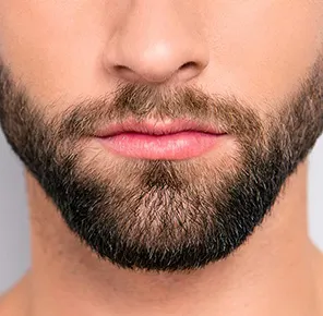beard Transplant Clinic