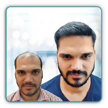 result-01